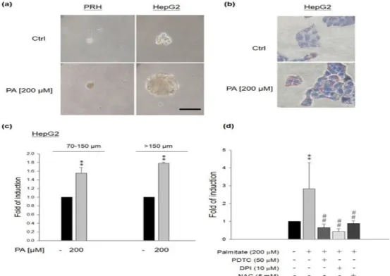 Figure 4. Effects  of  PA  on sphere formation in PRH and HepG2 cells.  (a)  PA  (200 μM) significantly  enhanced the sphere formation of HepG2 cells, but not PRH
