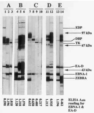 Fig. 1  Representative examples of immunoblot analysis using six recombinant EBV antigens to determine the serum IgA levels in five NPC patients