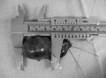 Fig. 1. The dimensions of the tumors were measured using a slide caliper. The measured points were marked using silk sutures.