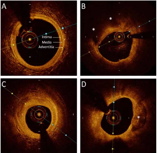 Table 1 summarizes image characteristics of  optical coherence tomography.