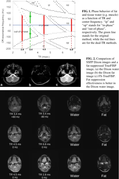 FIG. 3. The axial images of a female volunteer at the tongue level, showing the original  method (upper row: TR = 3.4 ms with  ±80 Hz adjustment), the dual-TR method version 1  (middle row: TR = 4.5 ms and TR = 6.8 ms) and the dual-TR version 2 (lower row:
