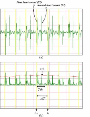 Fig. 5. Heart rate detection process and results. (a) the waveform of sounds after filtering,   (b) the waveform of sounds after envelope detection
