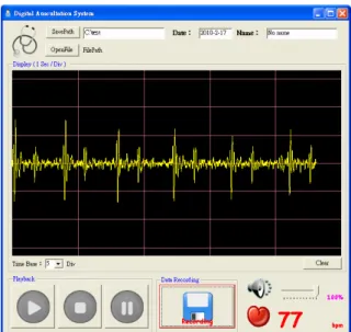 Fig. 7 shows the GUI and measuring results on the PC. The data of sounds received  from the ARM-based digital stethoscope via the USB can be real-time displayed as a  waveform on the GUI
