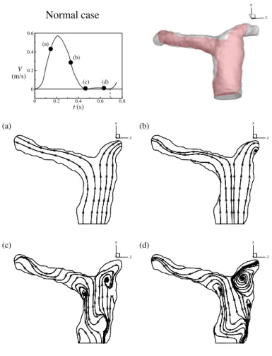 Figure 4: Evolution of streamlines in healthy pulmonary arteries within a cardiac cycle.