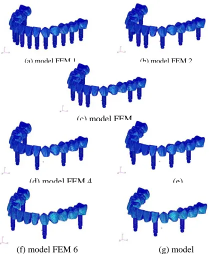 Table 3. Elastic properties of each material were  assigned to the finite element model 