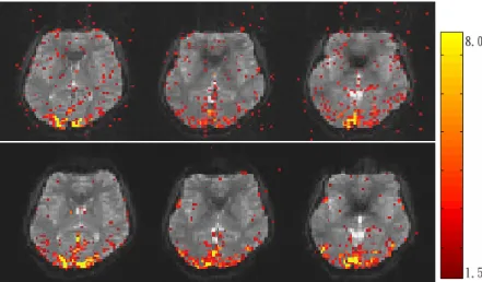 Fig 3. Activation maps of 3 selected slices of one subject: (a) conventional EPI and (b) 