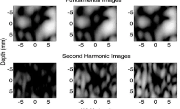 Figure 7.   B-scan phantom images with anechoic cyst.   