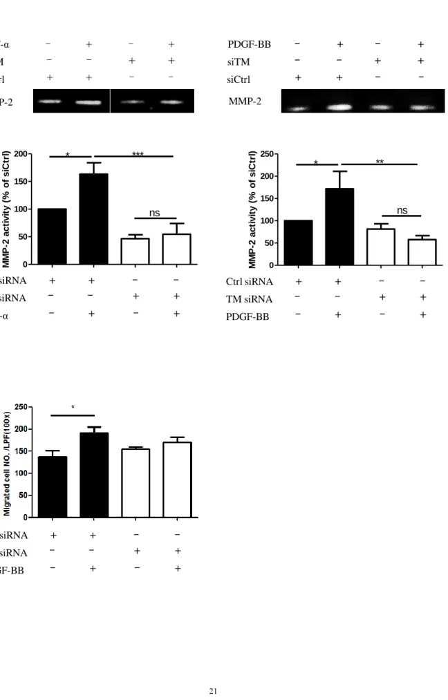 Figure 4 A. siCtrlsiTM TNF-α – – + +++– ––+–+ MMP-2 MMP-2siCtrlsiTM PDGF-BB – – + +++– ––+–+ B