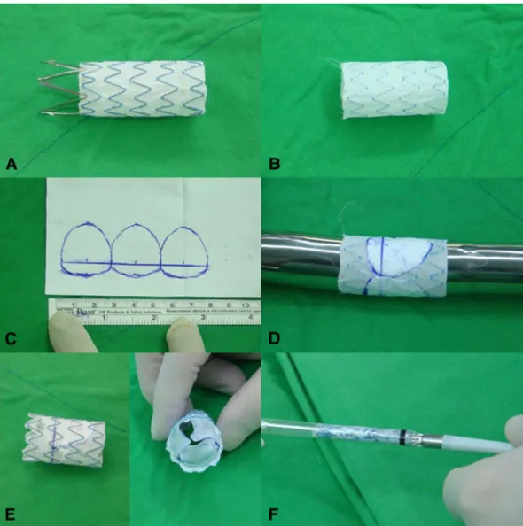 Fig. 1: The percutaneous transcatheter pulmonary valve deployment system     