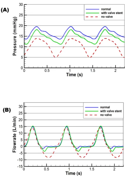 Fig. 3: Sample pressure and flowrate waveforms at the mock pulmonary artery 
