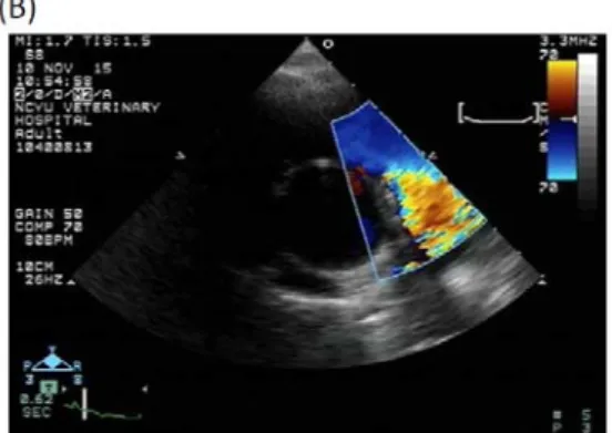 Fig. 5: Follow up echocardiography. 