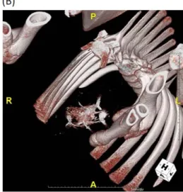 Fig 6. Follow up computed tomography (CT). 