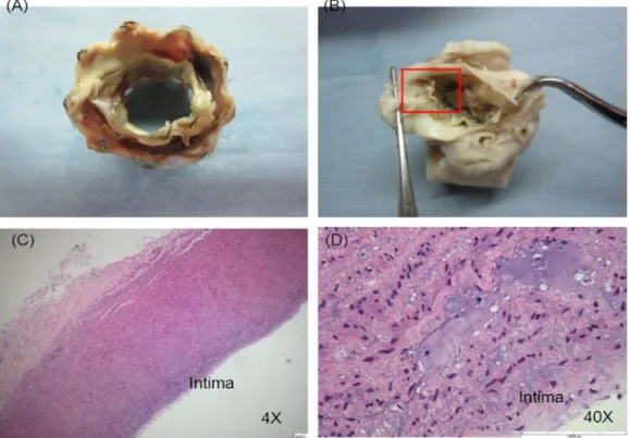 Fig. 7: Gross &amp; micro pathology. 