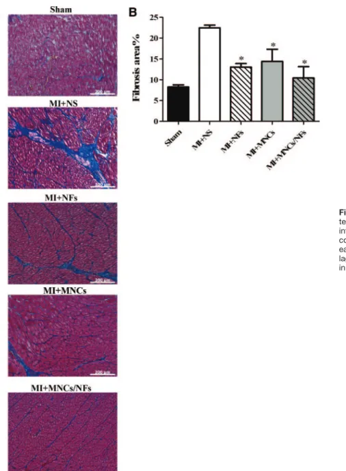 Figure 3. Injection of peptide NFs pro- pro-tects the remote zone from fibrosis after infarction