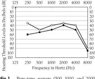 Fig 1. Pure-tone average (500, 1000, and 2000 Hz) of the right side of 48 dB (black circles) at the first evaluation and of 42 dB (white circles) before discharge