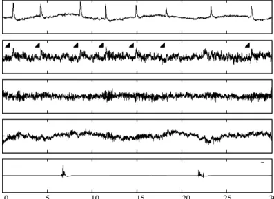 Figure 5. An example trial in naturally blinking state.    EOG stands for electrical signals recorded from forehead leads and other abbreviations  are described in the text