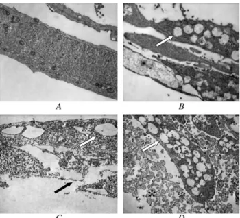 Figure 3. Transmission electron photomicrographs of cultured rabbit CECs after 1-minute exposure to control (BSS) (A; intact cell membrane, nucleus, organelles), cTA, (B), V (C), or BA 9 mg/mL (D)