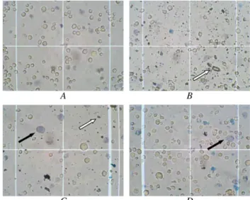 Figure 5. Light micrographs of rabbit corneal endothelial cells after 30- 30-minute exposure to control (BSS) (A), 1/10 –vTA in BSS (B), 1/10 dilution of commercial (V containing) TA (C), and pure V (D)