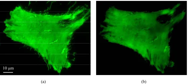Fig. 4. Live melanoma-GFP-tagged thrombomodulin SP-enhanced fluorescence images by  utilizing (a) the 1.49 NA oil-immersion objective and (b) the 1.0 NA water-immersion objective,  both with an exposure time of 0.5 sec at an incident angle of 77.5 o 