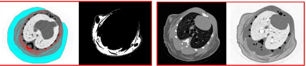 Fig 1.3 Micro CT  images  (a) Adipose  tissue of a mouse (b) Lung  tissue of a mouse  (Phil, 2007) 