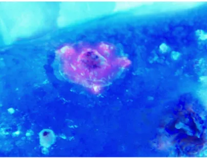 Fig. 1. Porphyrin metabolism in mammalian cells.    Application of ALA bypass the rate determining step of heme on ALA synthase which leads to PpIX accumulation
