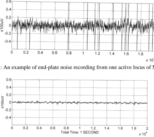 Fig 1: An example of end-plate noise recording from one active locus of MTrP.