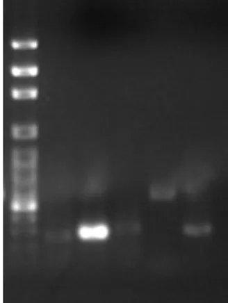 Figure 10. The mRNA Expression of GST2, MDR1, MRP1, MRP5 and GAPDH in PAECs. Lane 1: 100bp marker; Lane 2: GST 2; Lane 3: MDR1; Lane 4: MRP1; Lane 5: MRP5 and Lane 6: GADPH.