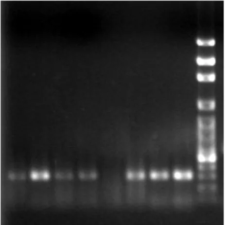Figure 14. MRP1 mRNA expression by Se-enriched broccoli extracts and sulforaphane (SF) pretreatments for 24 hr in As 2 O 3 -induced PAECs