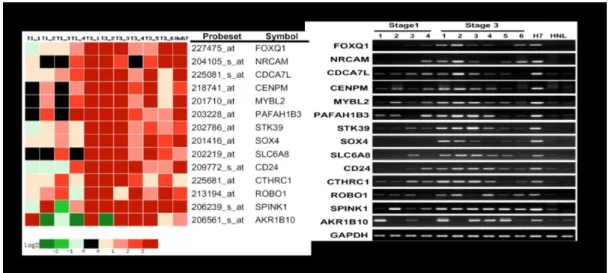 Figure 6. Microarray and RT-PCR analysis of SOX4 