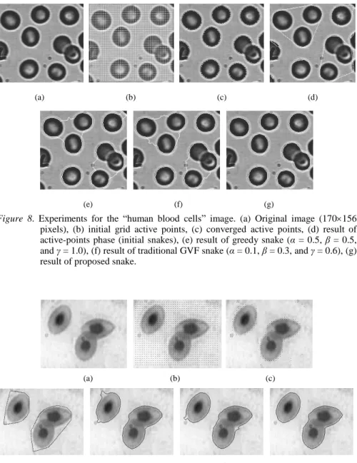 Figure 8. Experiments for the “ human blood cells”image. (a) Original image (170156 pixels), (b) initial grid active points, (c) converged active points, (d) result of active-points phase (initial snakes), (e) result of greedy snake (α= 0.5, β= 0.5, and γ