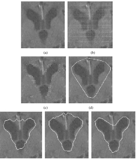 Figure 10. Exp e r i me nt s f or t he ‘ Br a i n’ CT  i mage . ( a ) Or i gi na l i ma ge ( 130 140 pixels), (b) initial grid active points, (c) converged active points, (d) result of active-points phase (initial snakes), (e) result of greedy snake (α= 0