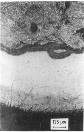 Figure 12.  Micrograph showing deep-etched section of the weld bead. 