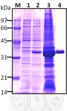 Figure 1. Expression and purification of OipA recombinant protein.   