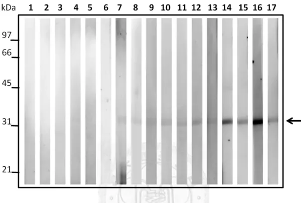 Figure 6. Immunoblotting of OipA recombinant protein using serum samples.   