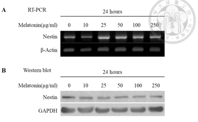 Figure 11. Expression of Nestin in apical papilla cells treated with different  concentrations of melatonin for 24 hours