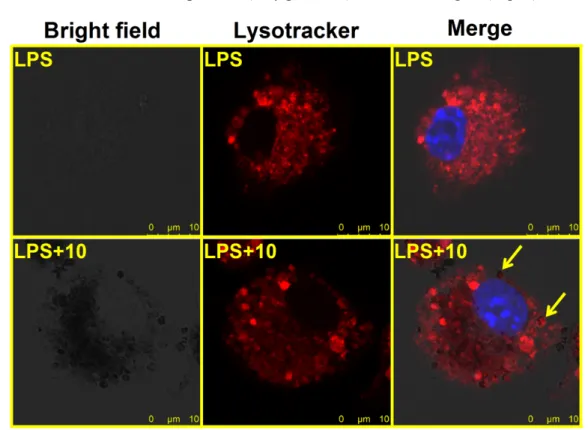 Figure 7. The distribution of iron oxide nanoparticles in lysosomes of  LPS-stimulated microglia