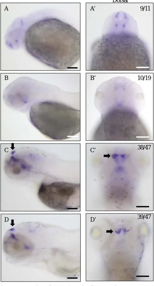 Figure 2. Expression patterns of rasd1 in various developmental stages. (A-D) Images  showing mRNA staining of rasd1 in (A and A’) 24hpf, (B and B’) 48hpf, (C and C’)72hpf, and  (D and D’) 96hpf