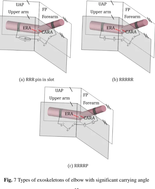 Fig. 7 Types of exoskeletons of elbow with significant carrying angle 