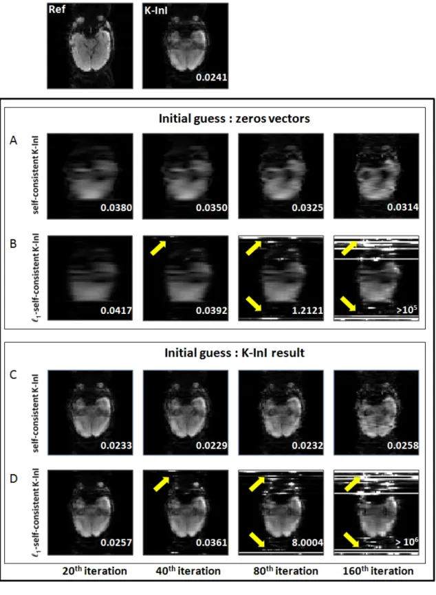 Figure 6.    The sum-of-squares reference image (SoS) and K-InI reconstruction. Panels  A and B show the self-consistent K-InI and the   1 -self-consistent K-InI reconstruction  after 20, 40, 80, and 160 iterations using a zero-vector as the initial value