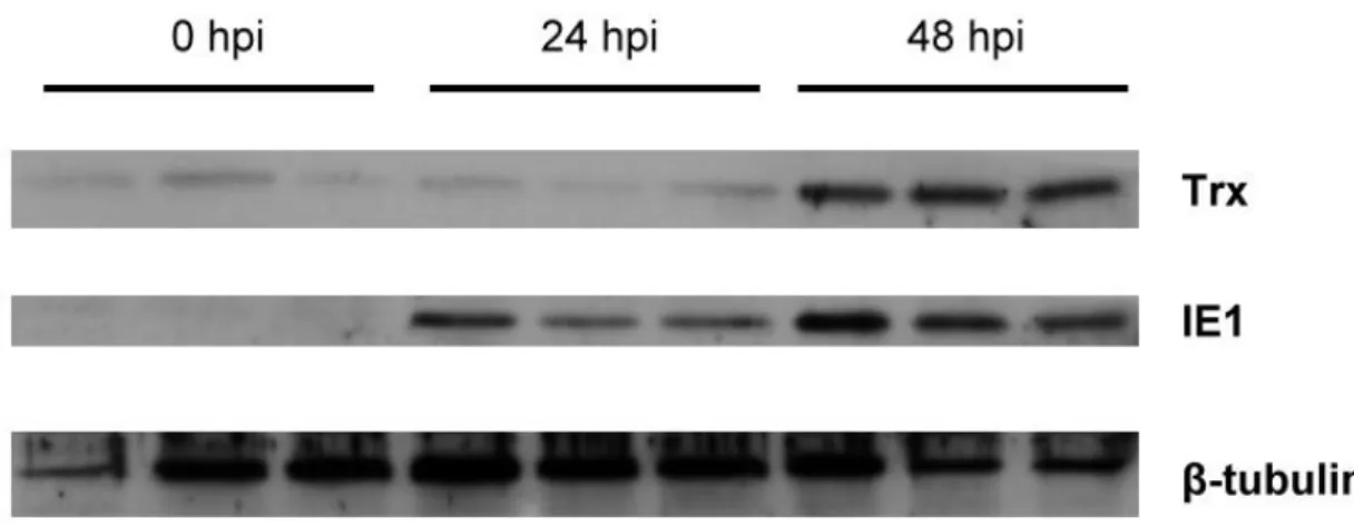 Figure  5.  Protein  expression  levels  of  P.  monodon  thioredoxin  and  WSSV  IE1  after  WSSV  challenge
