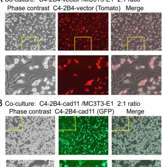 圖 3. Cadherin-11 促使前列腺癌細胞吸附於成骨細胞並改變細胞的形狀表現  (A)  在 C4-2B4/vector 與 MC3T3-E1 以 2:1 比例混合後，於細胞培養皿中，