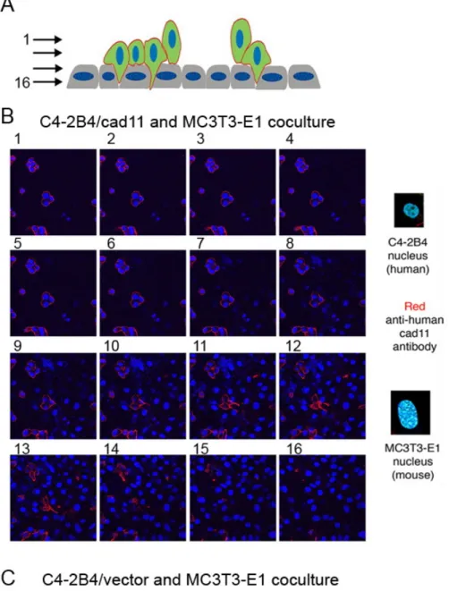 圖 5. Cadherin-11 促使前列腺癌細胞嵌入成骨細胞層 
