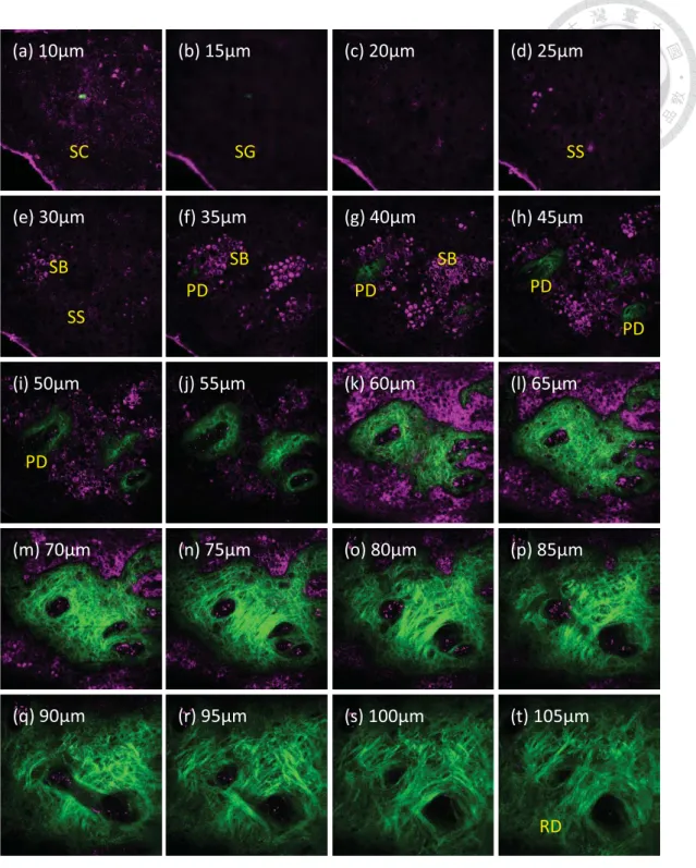 Fig. 2. A Part of a representative XYZ image stack combing SHG and THG signals from a 24-year-old  female subject