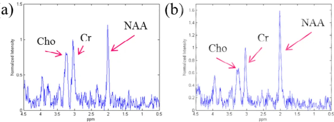 圖 4-8(a)、(b)各圖 4-7-b 為矩陣上左、右紋狀體內頻譜  圖 4-9(a)、(b)、(c)為針對各代謝物在化學位移上訊號分佈之積分影像，依次為 NAA、 Cr、Cho  紋狀體-左(a) 紋狀體-右(b) NAA-SNR 5.73  8.97  Cr-SNR 4.15  5.76  Cho-SNR 4.21  4.17  NAA/Cr 1.13  1.01  Cho/Cr 0.94  0.83  表 4-4  與圖 4-8(a)、(b)頻譜相對應代謝物之訊噪比及 X/Cr。 