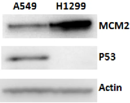 Figure 3. Endogenous expression of MCM2 in lung cancer cells. Protein samples (30  ug)  were  electrophoresed  on  a  10%  SDS  polyacrylamide  gel
