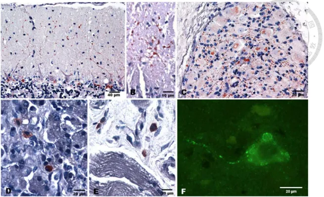 Figure 2. Viral antigen detection in the nervous and non-nervous tissues of rabid 