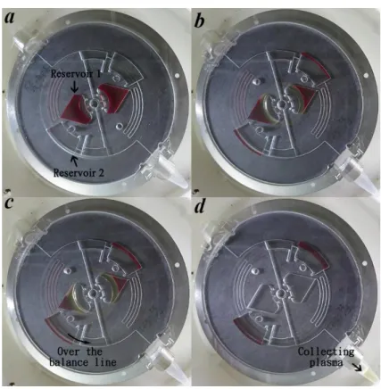 Figure 5.1 Plasma separation from whole blood on microfluidic disk. (a) whole blood  loaded into reservoir 1