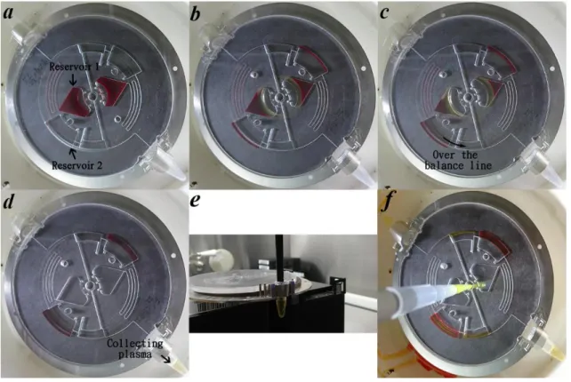 Figure 5.6 Protocol for the entire process of disk system. (a)-(d) Illustrate the process  of plasma separation and enrichment via microfluidic disk including (a) loading whole  blood  sample,  (b) plasma separation,  and (c)-(d) plasma enrichment