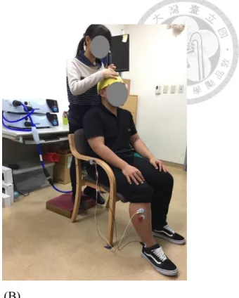 Figure 3. Transcranial magnetic stimulation (TMS). 