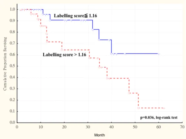 Figure 1. 2 Kaplan-Meier survival curve showing relation between AKR1B10 expression  in primary tumors and survival in 77 patients with oral squamous cell carcinoma (OSCC)